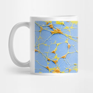 Pluripotent derived neurones, SEM, (C055/8975) Mug